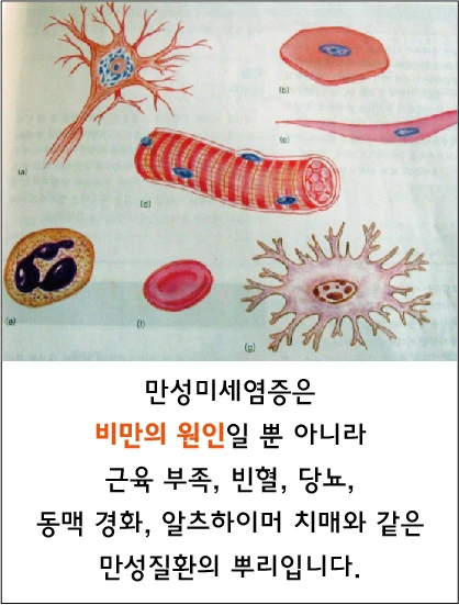 The post describes chronic low-grade inflammation as a cause of obesity and a root of chronic diseases such as insufficient muscle, anemia, diabetes, atherosclerosis and Alzheimer’s dementia.