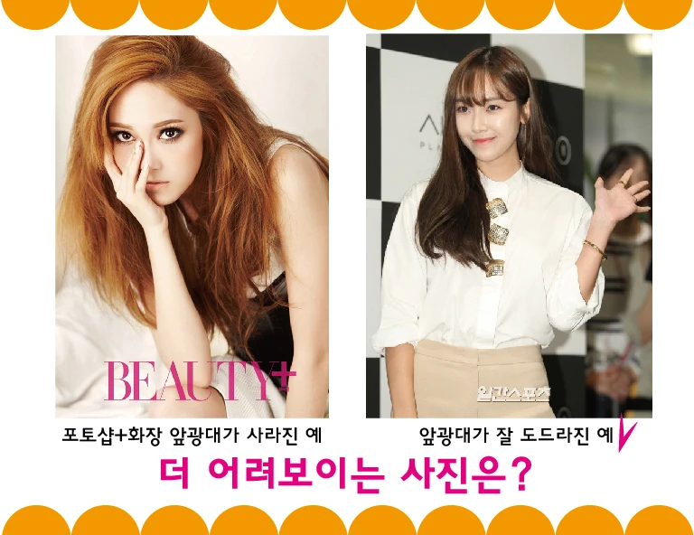 Left: an example in which Photoshop and makeup have removed the front-cheek prominence