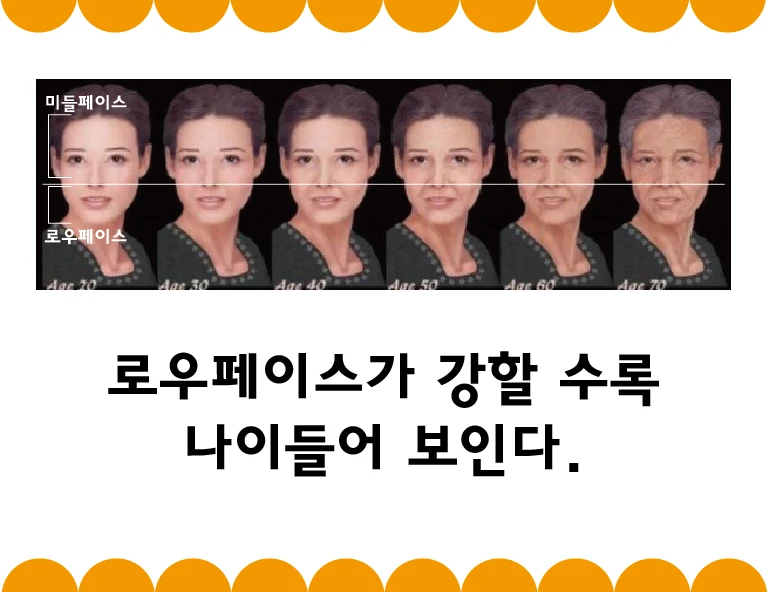 The more pronounced the lower face, the older a person looks.