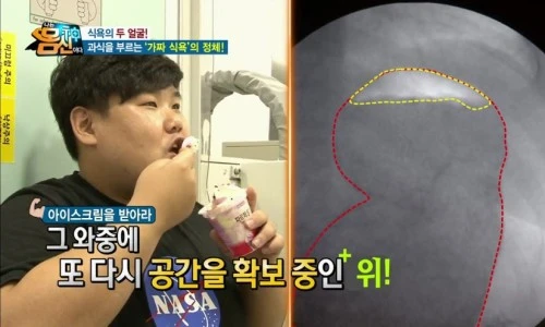 Television stomach-examination preview
