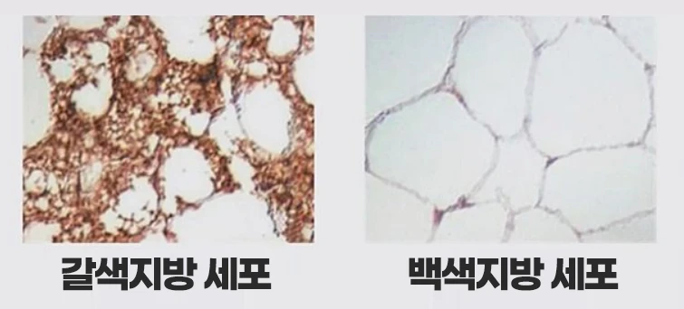 Brown and white fat-cell comparison